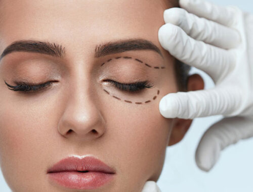 Latest Technological Advancements in Eyelid Surgery Available in Dubai