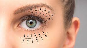 Myths and Misconceptions About Eyelid Surgery