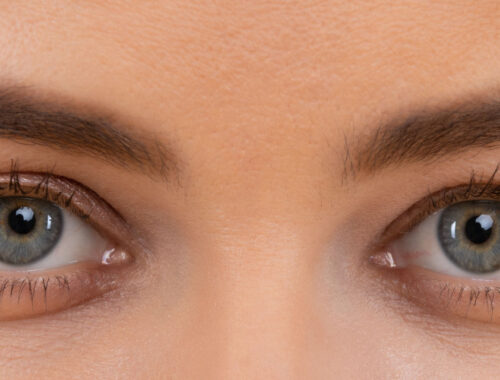 Eyelid Surgery for Excess Skin Removal