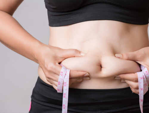 Liposuction in Dubai