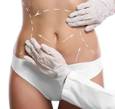 How to Choose the Best Liposuction Surgeon in Dubai: A Step-by-Step Guide