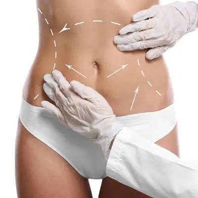 How to Choose the Best Liposuction Surgeon in Dubai: A Step-by-Step Guide