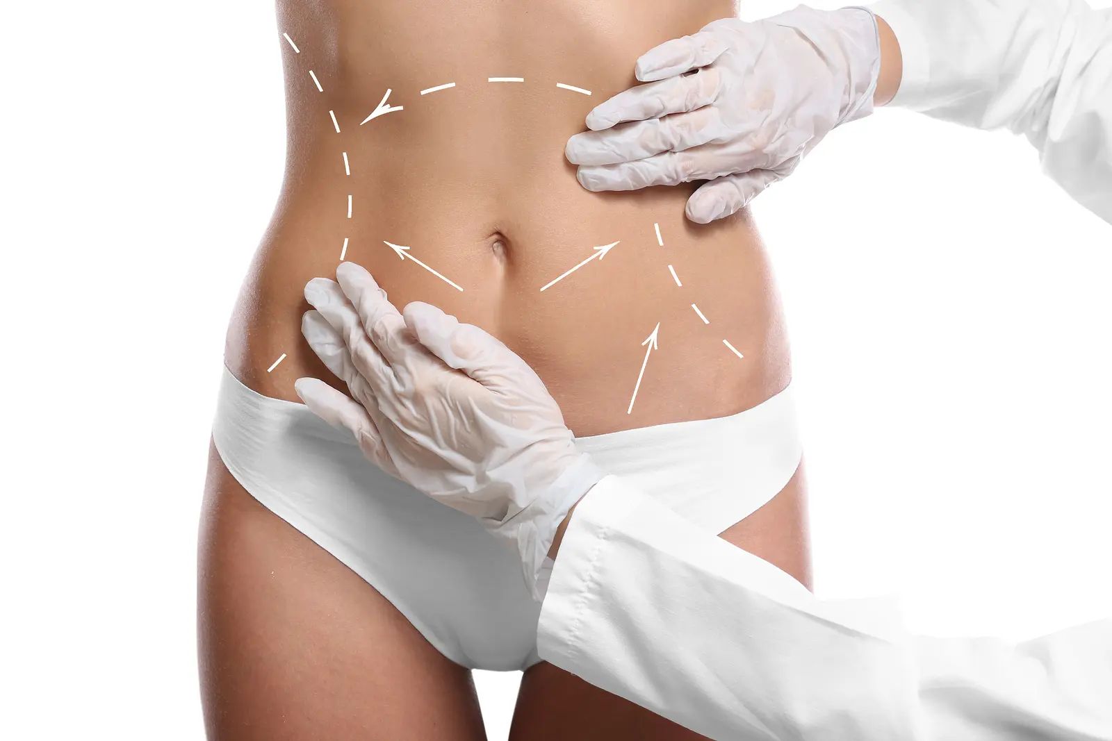 How to Prepare Your Questions for the Best Full Body Liposuction Surgeons in Dubai